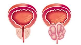 the prostate gland